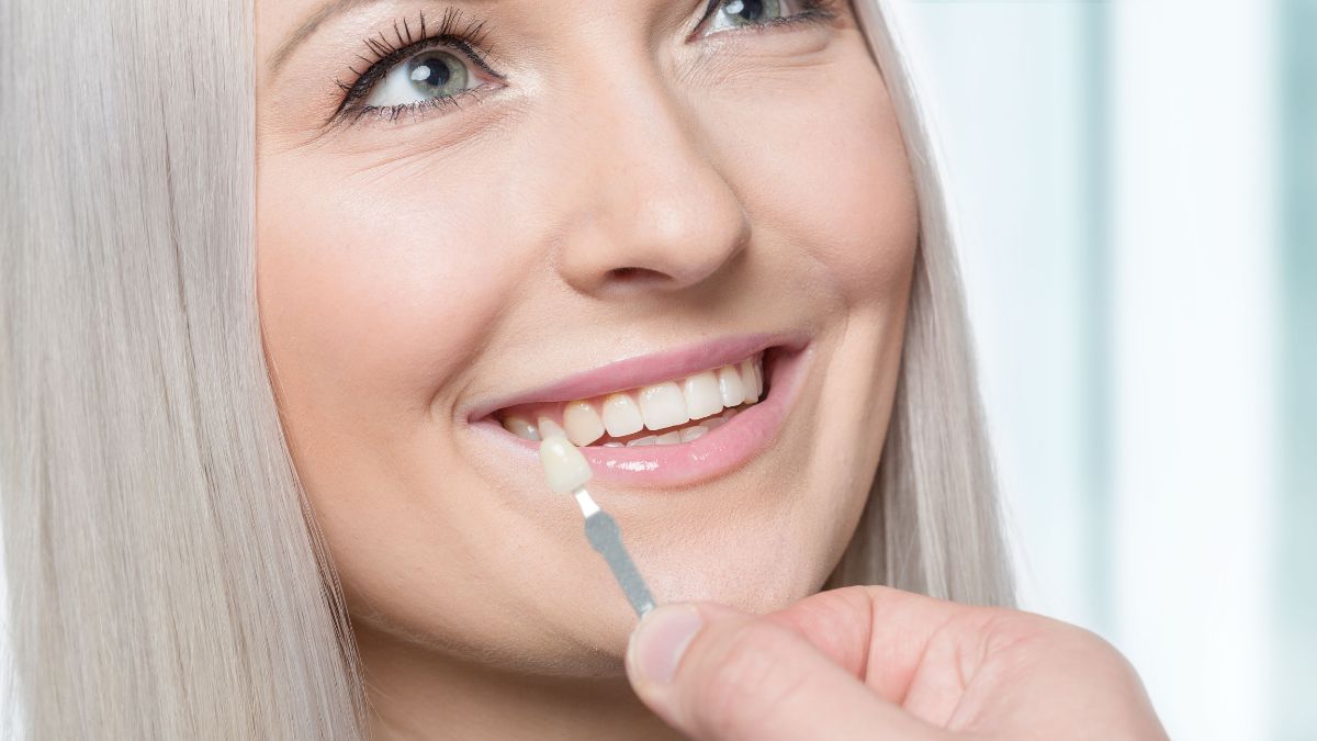 How to Choose Veneers That Suit Your Smile